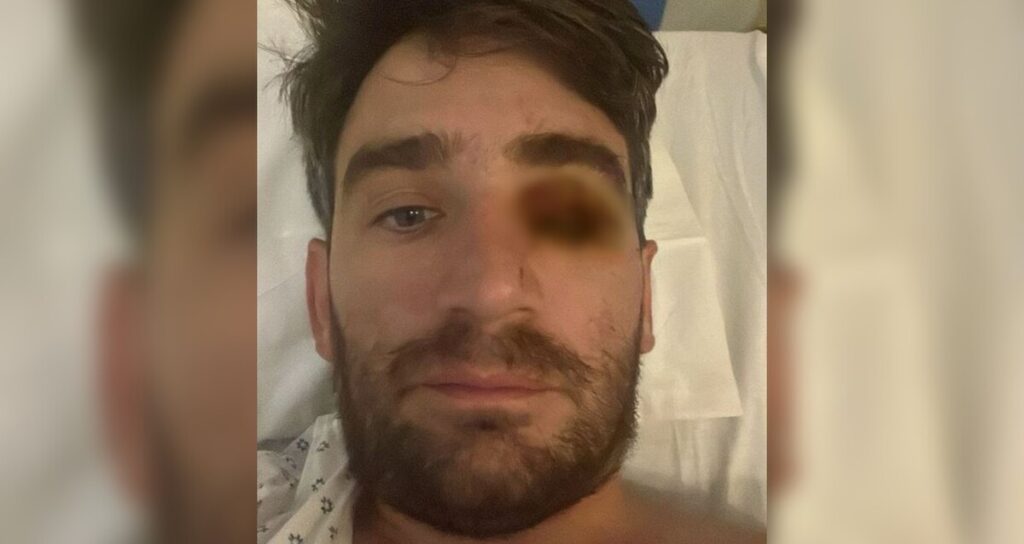 Hombre pierde ojo en un trágico accidente por fuegos artificiales durante la fiesta de Año Nuevo