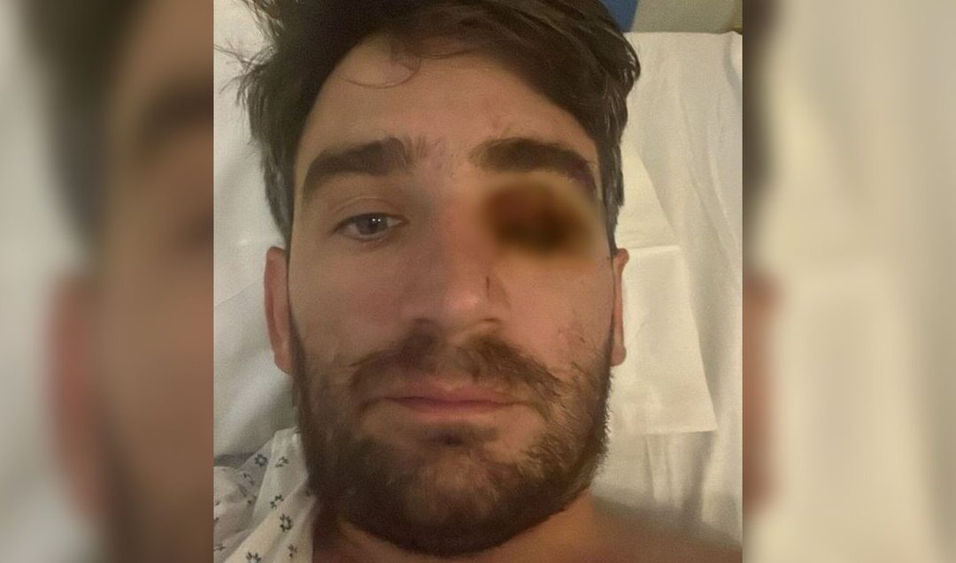 Hombre pierde ojo en un trágico accidente por fuegos artificiales durante la fiesta de Año Nuevo